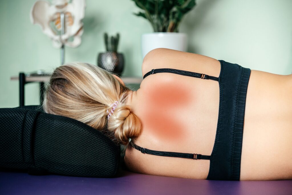 Woman lying on a therapy table with a highlighted lower back trigger point commonly associated with muscle pain and tension.
